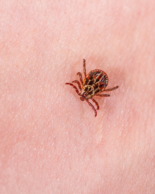 Bitten by a Tick? What to Do Next